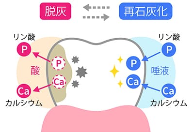 脱灰と再石灰化